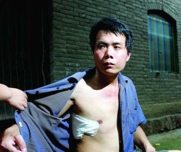 尘肺病的相关知识